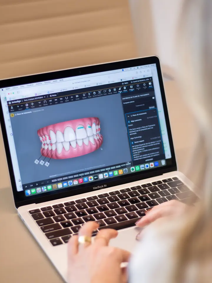 Planejamento Invisalign na tela do computador