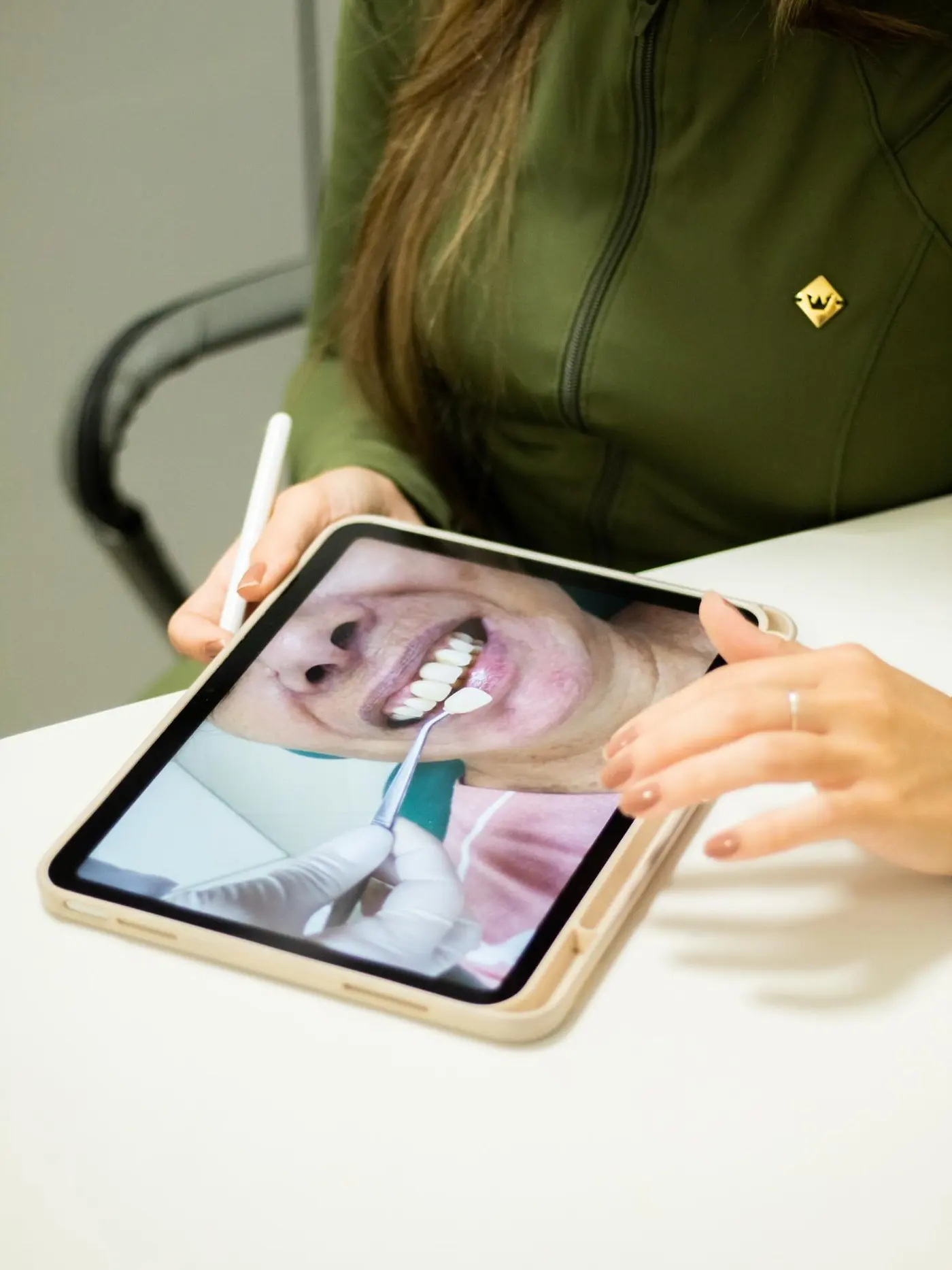 Planejamento do sorriso no tablet