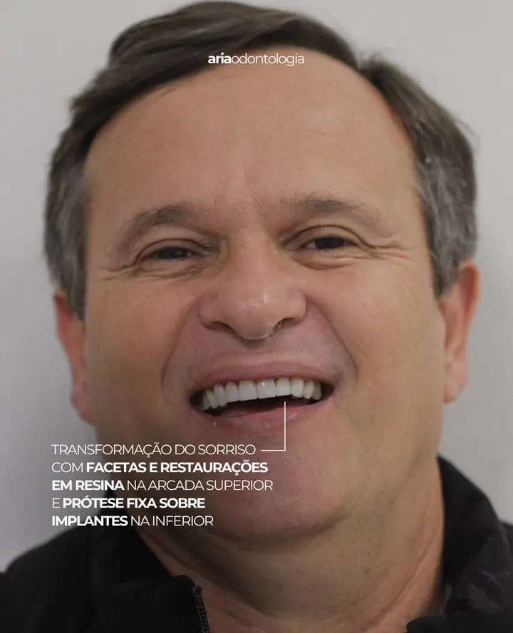 Paciente sorrindo depois do tratamento